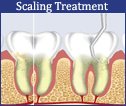 sasi dental clinic nagercoil
